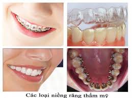 Giải pháp thẩm mỹ răng hoàn hảo 2 Giải pháp thẩm mỹ răng hoàn hảo 2