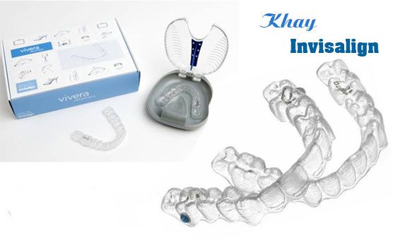 Niềng răng không mắc cài 3 Niềng răng không mắc cài 3