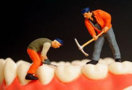 Trám răng có phải là giải pháp tối ưu cho răng sâu ?
