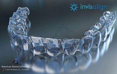 niềng răng invisalign là gì