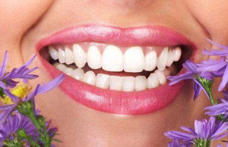 niềng răng móm như thế nào