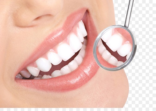 Những điều cần biết về bọc răng sứ 1 Những điều cần biết về bọc răng sứ 1