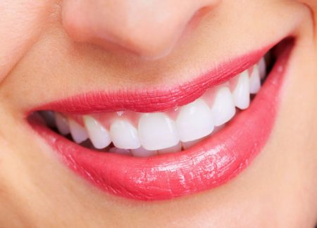 Có thể tẩy trắng răng sâu được không? 1 Có thể tẩy trắng răng sâu được không? 1