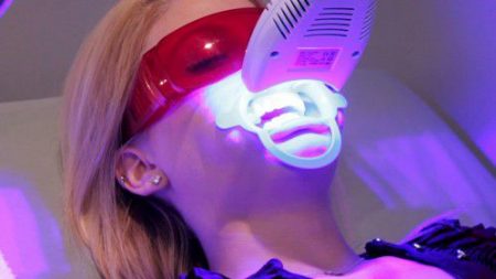 Tẩy trắng răng bằng Laser Whitening có hại không? 1 Tẩy trắng răng bằng Laser Whitening có hại không? 1