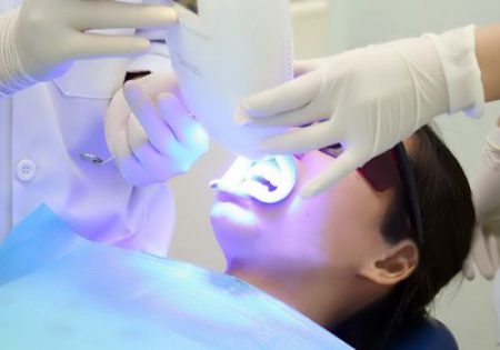 Tẩy trắng răng khi mang bầu có được không? 3 Tẩy trắng răng khi mang bầu có được không? 3