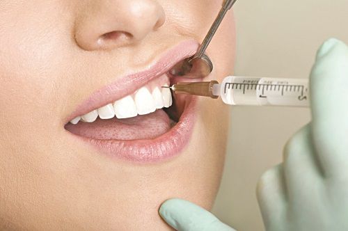 Mọc răng khôn hàm trên phải làm gì? 3 Mọc răng khôn hàm trên phải làm gì? 3
