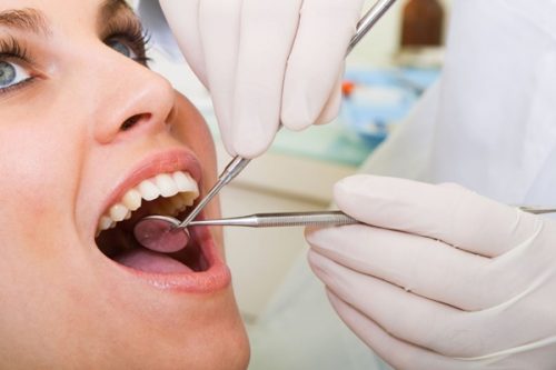 Mọc răng khôn uống thuốc gì? 3 Mọc răng khôn uống thuốc gì? 3
