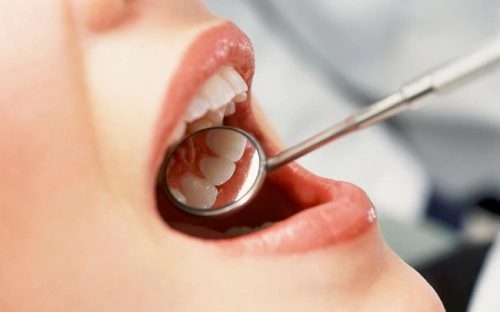 Nhổ răng khôn có nguy hiểm không? 3 Nhổ răng khôn có nguy hiểm không? 3
