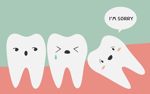 Nhổ răng khôn đau mấy ngày là hết? 1 Nhổ răng khôn đau mấy ngày là hết? 1