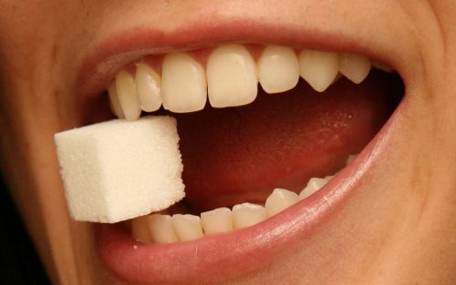 Răng lấy tủy có nên bọc lại không? 3 Răng lấy tủy có nên bọc lại không? 3