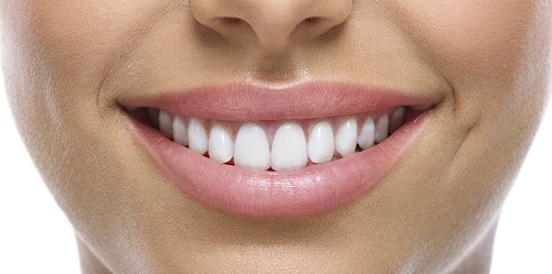 Bọc răng sứ chữa hô có mang lại hiệu quả không? 2 Bọc răng sứ chữa hô có mang lại hiệu quả không? 2
