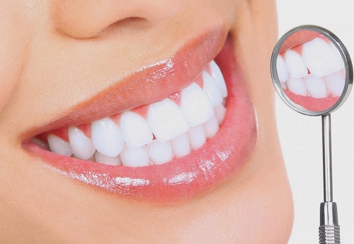 Bọc răng sứ chữa hô có mang lại hiệu quả không? 4 Bọc răng sứ chữa hô có mang lại hiệu quả không? 4