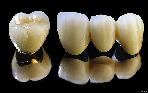 Bọc răng sứ giá bao nhiêu tiền? Thông tin về dịch vụ bọc răng sứ 1 Bọc răng sứ giá bao nhiêu tiền? Thông tin về dịch vụ bọc răng sứ 1