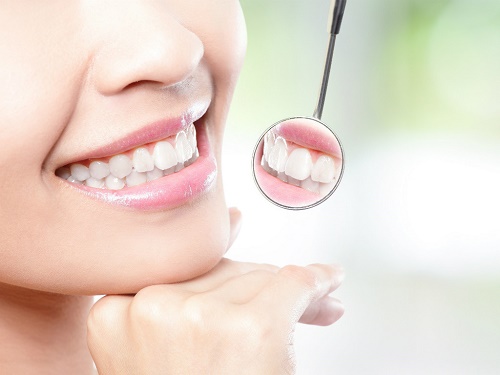 Bọc răng sứ giá bao nhiêu tiền? Thông tin về dịch vụ bọc răng sứ 4 Bọc răng sứ giá bao nhiêu tiền? Thông tin về dịch vụ bọc răng sứ 4