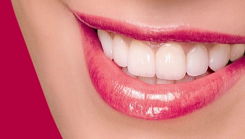 Bọc răng sứ ở đâu đẹp và tự nhiên nhất? 1 Bọc răng sứ ở đâu đẹp và tự nhiên nhất? 1