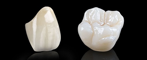 Thực tế bọc sứ răng cửa giá bao nhiêu tiền là phù hợp 2 Thực tế bọc sứ răng cửa giá bao nhiêu tiền là phù hợp 2