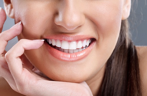Chi phí niềng răng mắc cài tự đóng bao nhiêu? 3 Chi phí niềng răng mắc cài tự đóng bao nhiêu? 3