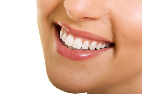 3 cách chỉnh răng đều không cần niềng cho bạn 4 3 cách chỉnh răng đều không cần niềng cho bạn 4