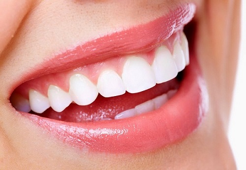 Có nên bọc răng sứ titan không? Nên lưu ý gì khi bọc răng sứ titan 2 Có nên bọc răng sứ titan không? Nên lưu ý gì khi bọc răng sứ titan 2