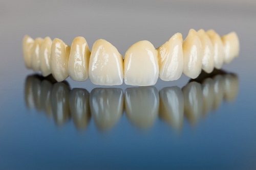Có nên bọc răng sứ titan không? Nên lưu ý gì khi bọc răng sứ titan 3 Có nên bọc răng sứ titan không? Nên lưu ý gì khi bọc răng sứ titan 3
