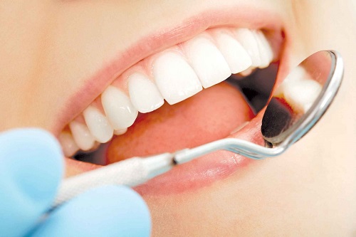 Có nên bọc răng sứ titan không? Nên lưu ý gì khi bọc răng sứ titan 4 Có nên bọc răng sứ titan không? Nên lưu ý gì khi bọc răng sứ titan 4