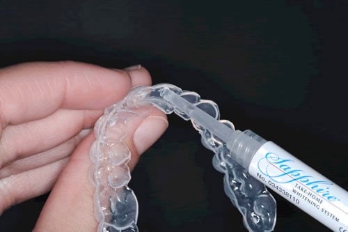 Cách sử dụng gel tẩy trắng răng đơn giản nhất 2 Cách sử dụng gel tẩy trắng răng đơn giản nhất 2