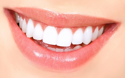 Tư vấn giá làm răng sứ venus phù hợp cho từng trường hợp 2 Tư vấn giá làm răng sứ venus phù hợp cho từng trường hợp 2