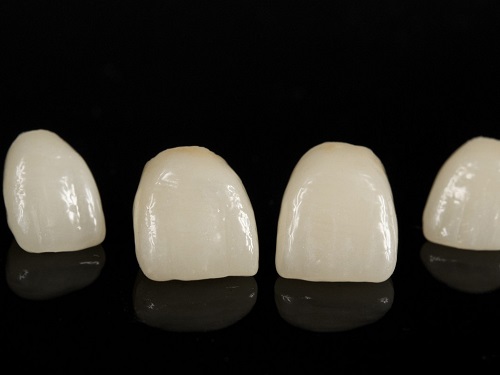 Tìm hiểu 4 đặc điểm sau để biết làm răng sứ ở đâu tốt 1 Tìm hiểu 4 đặc điểm sau để biết làm răng sứ ở đâu tốt 1