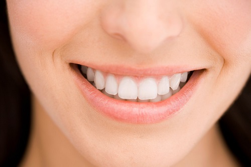 Tư vấn về vấn đề niềng răng có nguy hiểm không cho bạn? 4 Tư vấn về vấn đề niềng răng có nguy hiểm không cho bạn? 4