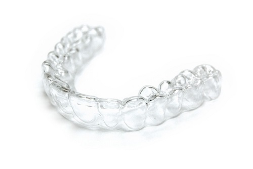 Phương pháp niềng răng không mắc cài 3D Clear Aligner 1 Phương pháp niềng răng không mắc cài 3D Clear Aligner 1
