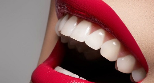 Bọc răng sứ titan có bị đen không? 2 Bọc răng sứ titan có bị đen không? 2