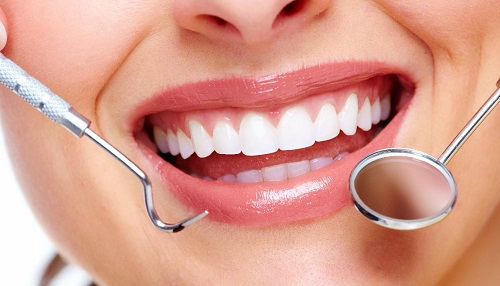 Bọc răng sứ titan có bị đen không? 4 Bọc răng sứ titan có bị đen không? 4