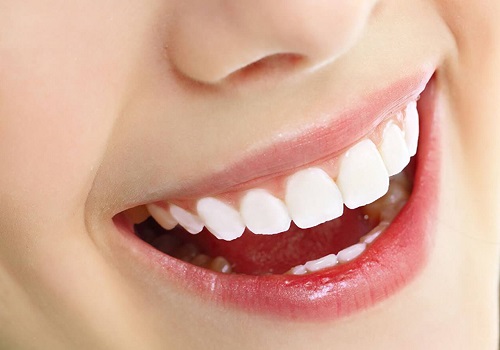 Bọc răng sứ nguyên hàm giá bao nhiêu là có thể thực hiện 2 Bọc răng sứ nguyên hàm giá bao nhiêu là có thể thực hiện 2