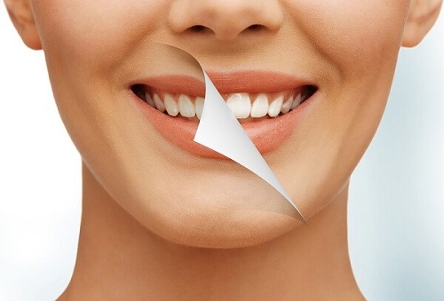 Bác sĩ khuyên nên ăn gì sau khi tẩy trắng răng? 3 Bác sĩ khuyên nên ăn gì sau khi tẩy trắng răng? 3