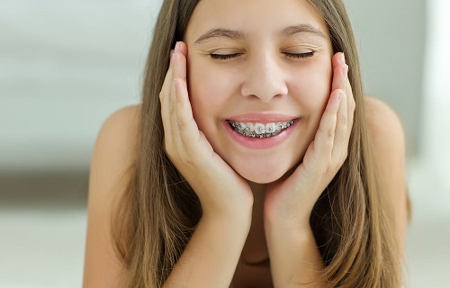Niềng răng khểnh mấy bao lâu thì đều và đẹp 3 Niềng răng khểnh mấy bao lâu thì đều và đẹp 3