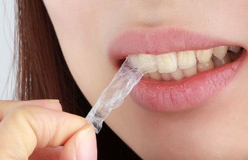 Tác hại của việc tẩy trắng răng bạn cần biết 2 Tác hại của việc tẩy trắng răng bạn cần biết 2