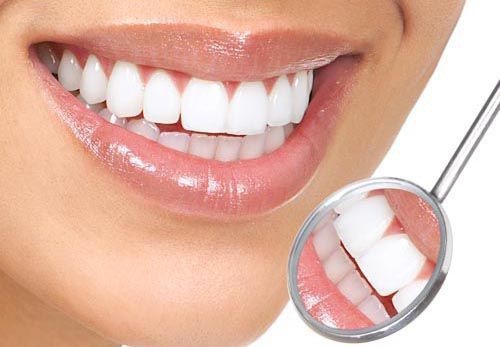 Xu hướng tẩy trắng răng brite smile 2018 hiệu quả cao 1 Xu hướng tẩy trắng răng brite smile 2018 hiệu quả cao 1
