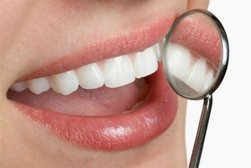Chảy máu chân răng là bệnh gì? Tư vấn cảnh báo từ nha khoa 3