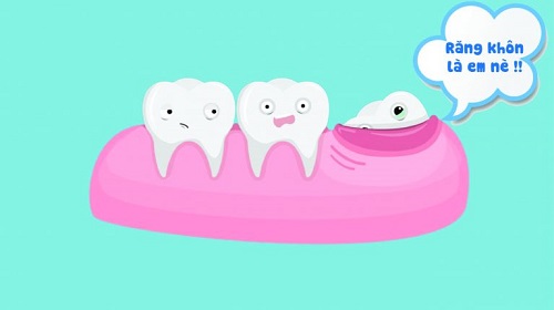 Răng khôn là răng số mấy? Ở vị trí nào trong khoang miệng 1 Răng khôn là răng số mấy? Ở vị trí nào trong khoang miệng 1