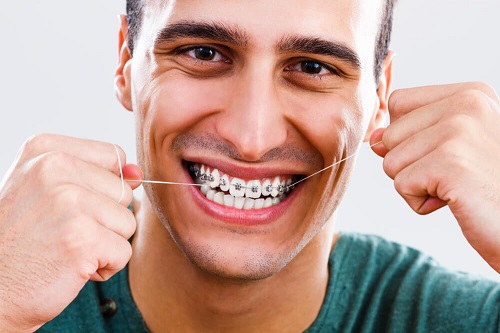 Ê buốt khi niềng răng - Xuất hiện tình trạng này có sao không? 3 Ê buốt khi niềng răng - Xuất hiện tình trạng này có sao không? 3