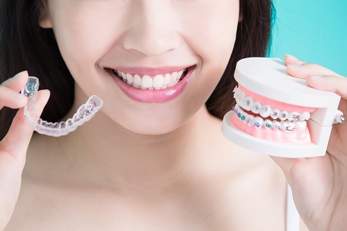 Niềng răng bị hóp má trong là do đâu gây ra? 1 Niềng răng bị hóp má trong là do đâu gây ra? 1