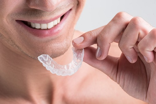 Niềng răng bị lòi chân răng - Bác sĩ nói gì về vấn đề này? 2 Niềng răng bị lòi chân răng - Bác sĩ nói gì về vấn đề này? 2