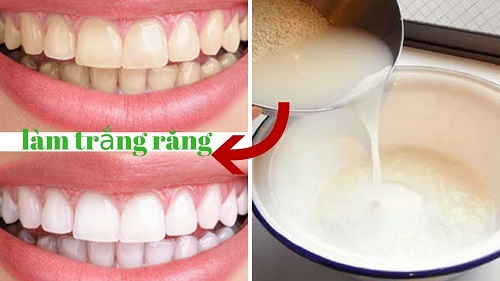 Tẩy trắng răng bằng nước gạo có hiệu quả không? 3 Tẩy trắng răng bằng nước gạo có hiệu quả không? 3