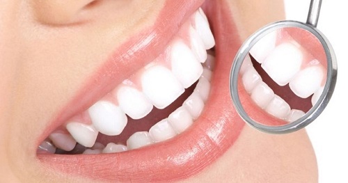Sau khi tẩy trắng răng có được uống bia không bác sĩ? 3 Sau khi tẩy trắng răng có được uống bia không bác sĩ? 3