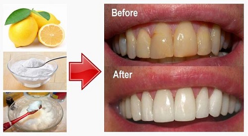 5 mẹo tẩy trắng răng trong 1 tuần cho bạn 3 5 mẹo tẩy trắng răng trong 1 tuần cho bạn 3