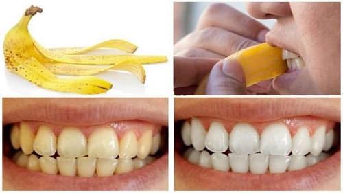 5 mẹo tẩy trắng răng trong 1 tuần cho bạn 4 5 mẹo tẩy trắng răng trong 1 tuần cho bạn 4