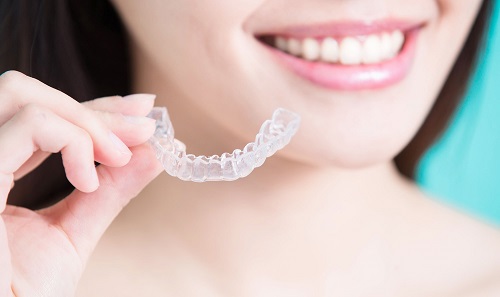 Niềng răng lệch nhân trung - Cách khắc phục cho khuôn hàm đẹp 3 Niềng răng lệch nhân trung - Cách khắc phục cho khuôn hàm đẹp 3
