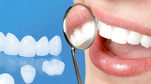 Những điều cần biết về răng sứ ceramill cho bạn 2 Những điều cần biết về răng sứ ceramill cho bạn 2