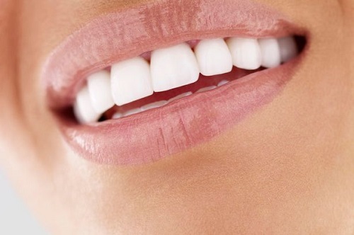 Những điều cần biết về răng sứ ceramill cho bạn 3 Những điều cần biết về răng sứ ceramill cho bạn 3