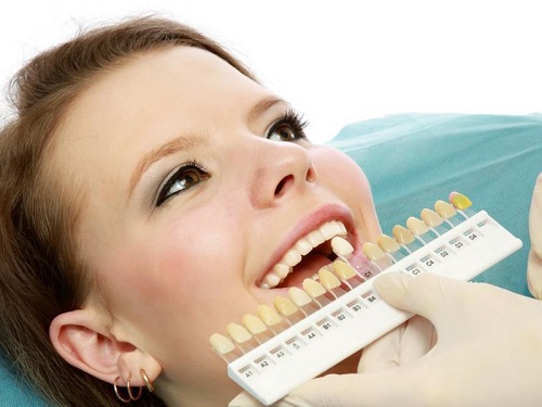 Răng sứ có mài được không phụ thuộc vào kích thước của răng 3 Răng sứ có mài được không phụ thuộc vào kích thước của răng 3